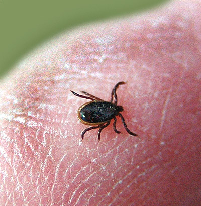 A small black Ioxdes Tick on a man's finger
